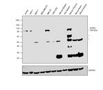 SATB1 Antibody in Western Blot (WB)