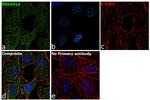 PRKAR1A Antibody in Immunocytochemistry (ICC/IF)