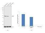 PRKAR1A Antibody in Western Blot (WB)