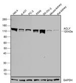 ATP Citrate Lyase Antibody in Western Blot (WB)