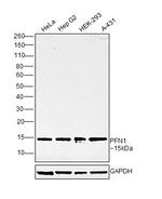 Profilin 1 Antibody in Western Blot (WB)