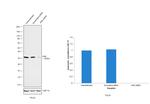 KHK Antibody in Western Blot (WB)