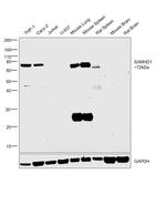 SAMHD1 Antibody in Western Blot (WB)