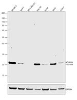 NDUFB9 Antibody in Western Blot (WB)