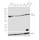 LIMK1 Antibody in Western Blot (WB)