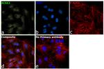 ACSS2 Antibody in Immunocytochemistry (ICC/IF)