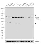 ACSS2 Antibody in Western Blot (WB)