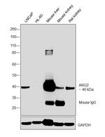 Arginase 2 Antibody in Western Blot (WB)