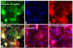 OAS2 Antibody in Immunocytochemistry (ICC/IF)