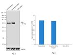 GBA Antibody in Western Blot (WB)