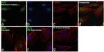 KLF2 Antibody in Immunocytochemistry (ICC/IF)