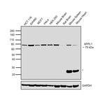 APPL1 Antibody in Western Blot (WB)