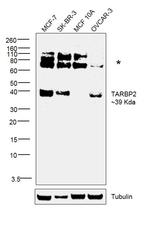 TRBP Antibody in Western Blot (WB)