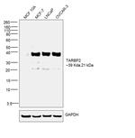 TRBP Antibody in Western Blot (WB)