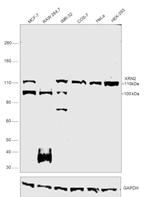 XRN2 Antibody in Western Blot (WB)