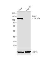 ROR2 Antibody