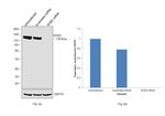 ROR2 Antibody in Western Blot (WB)