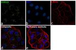 CCDC22 Antibody in Immunocytochemistry (ICC/IF)