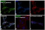 IGF2BP3 Antibody in Immunocytochemistry (ICC/IF)