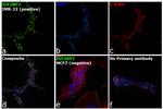 IGF2BP3 Antibody