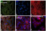 Fumarase Antibody