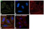 Fumarase Antibody in Immunocytochemistry (ICC/IF)