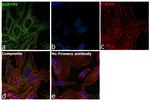 SQSTM1 Antibody in Immunocytochemistry (ICC/IF)