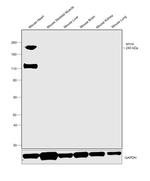 MYH6 Antibody in Western Blot (WB)