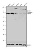 Dicer Antibody in Western Blot (WB)