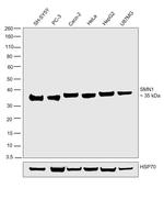 SMN1/SMN2 Antibody in Western Blot (WB)