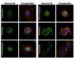 Aurora B Antibody in Immunocytochemistry (ICC/IF)