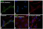 CD10 Antibody