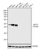 Cytokeratin 17 Antibody in Western Blot (WB)