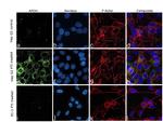 Apolipoprotein H Antibody