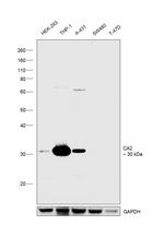 Carbonic Anhydrase II Antibody in Western Blot (WB)