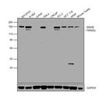 MSH6 Antibody in Western Blot (WB)