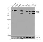 MSH6 Antibody in Western Blot (WB)