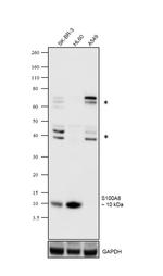 S100A8 Antibody in Western Blot (WB)