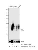 SOD2 Antibody in Western Blot (WB)