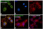 PD-L1 Antibody