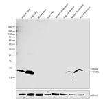 S100A6 Antibody in Western Blot (WB)