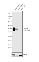 TROP2 Antibody