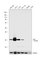 Carbonic Anhydrase II Antibody in Western Blot (WB)