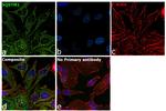 SQSTM1 Antibody in Immunocytochemistry (ICC/IF)