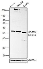 SQSTM1 Antibody in Western Blot (WB)