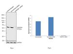 SQSTM1 Antibody in Western Blot (WB)