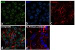 ATM Antibody in Immunocytochemistry (ICC/IF)