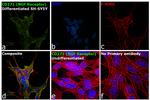 CD271 (NGF Receptor) Antibody in Immunocytochemistry (ICC/IF)