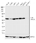 MLKL Antibody in Western Blot (WB)