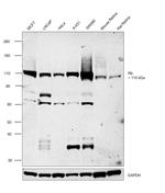 Rb Antibody in Western Blot (WB)